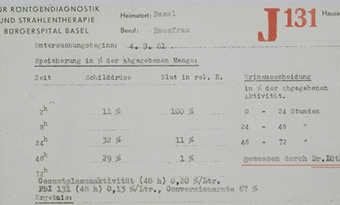 Auszug aus der nuklearmedizinischen Krankengeschichte aus dem Jahre 1961 über die Jodaufnahme (Jod-131) einer Patientin bei Hyperthyreose-Abklärung