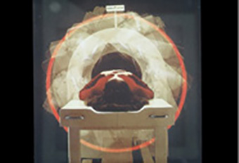  Darstellung der Funktionsweise einer nuklearmedizinischen Tomographie (SPECT)
